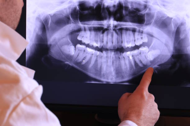 Best Broken Tooth Emergency  in Mount Prospect, IL